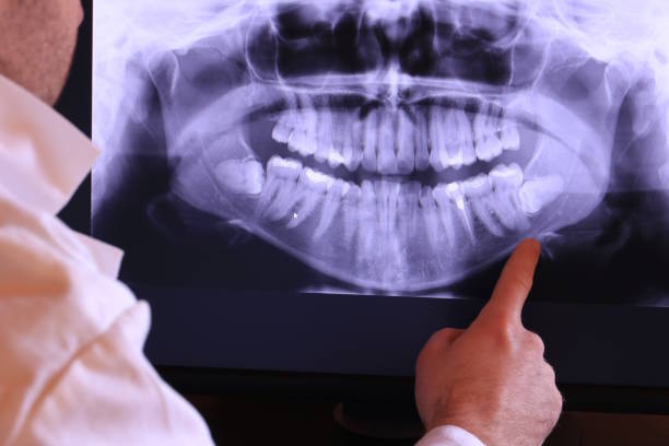 Best Emergency Denture Repair in Willits, CA
