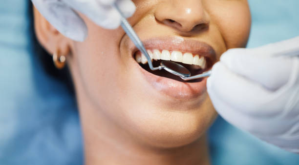 Best Pediatric Emergency Dentist in Willits, CA