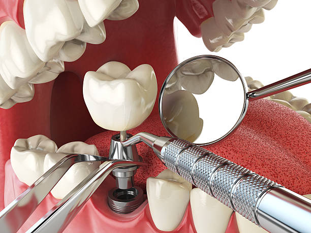 Best Same-Day Emergency Dental Services in Willits, CA